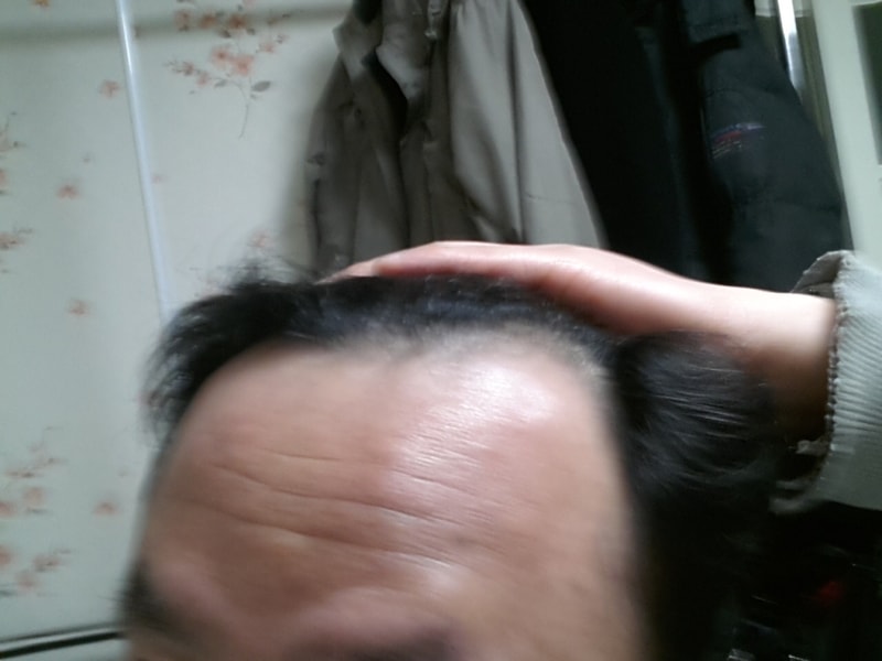 전1측면.jpg