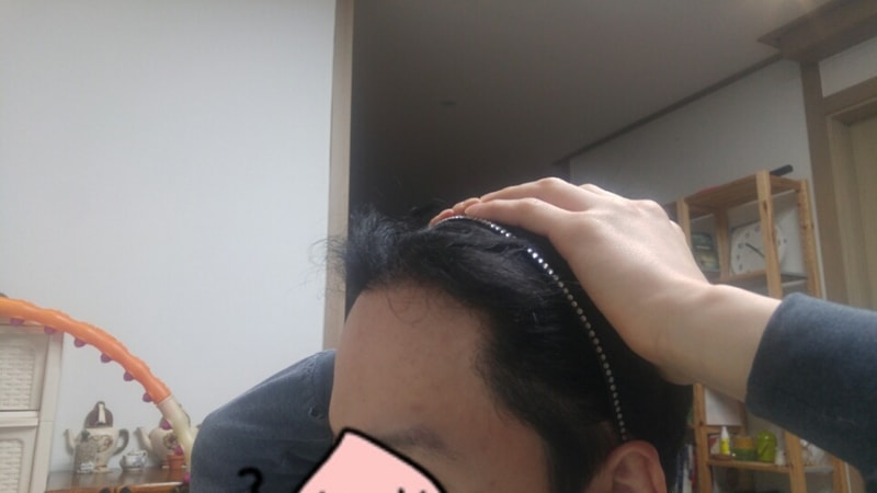 뉴헤어 6개월 후기