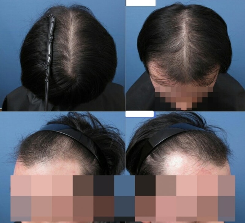 10월차 사진기록