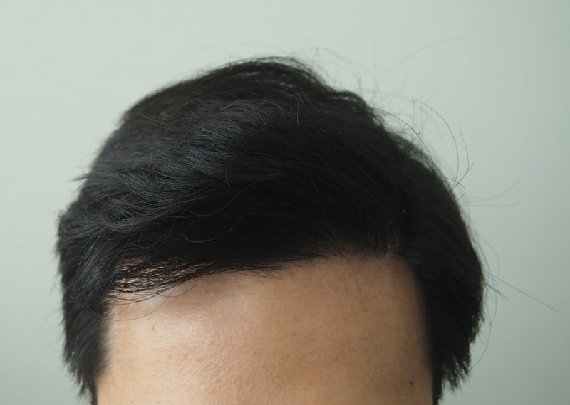 후 1.jpg