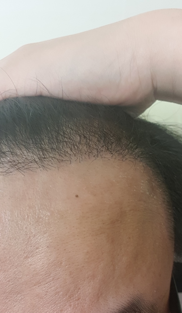 20180307_204101.jpg