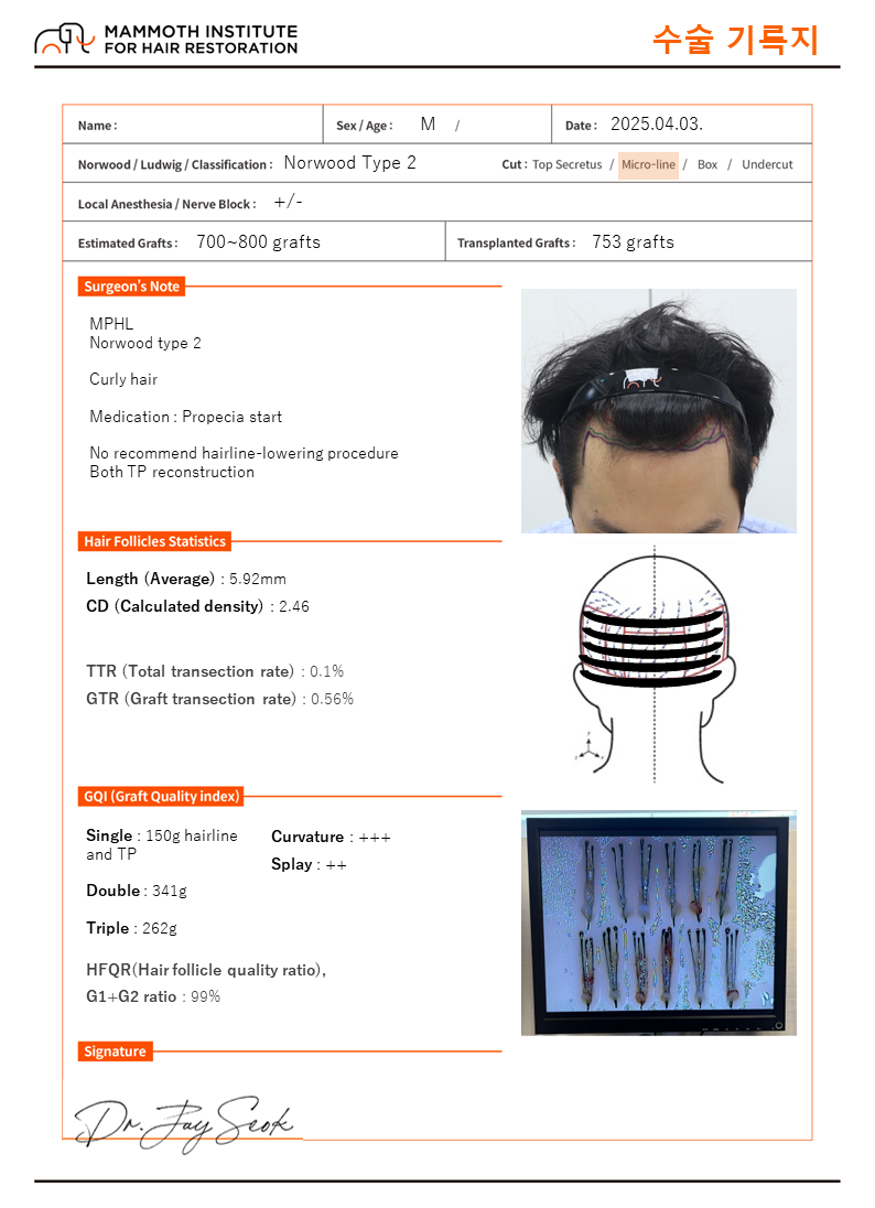 압구정 맘모스 헤어라인, 블루투스 비절개 슬릿 모발이식 후기(M자)
