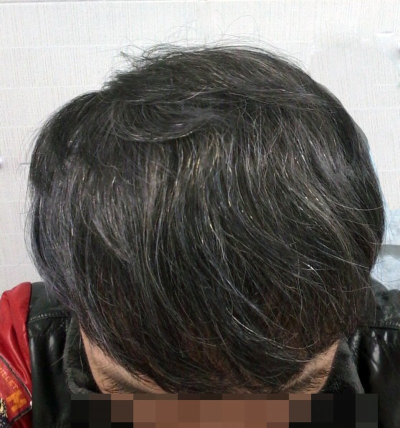 사본 -20170302_114714.jpg