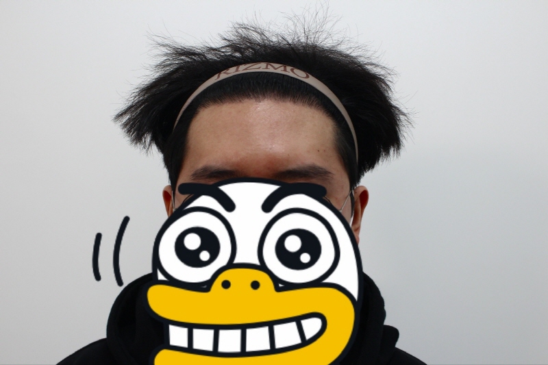 8개월 경과 헤어라인-멀리서.jpg