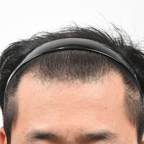 술전.JPG