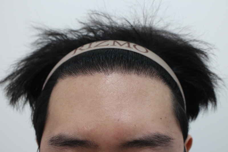 8개월 경과.jpg