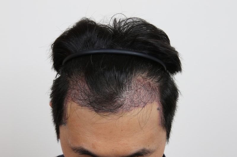 1일정면.jpg