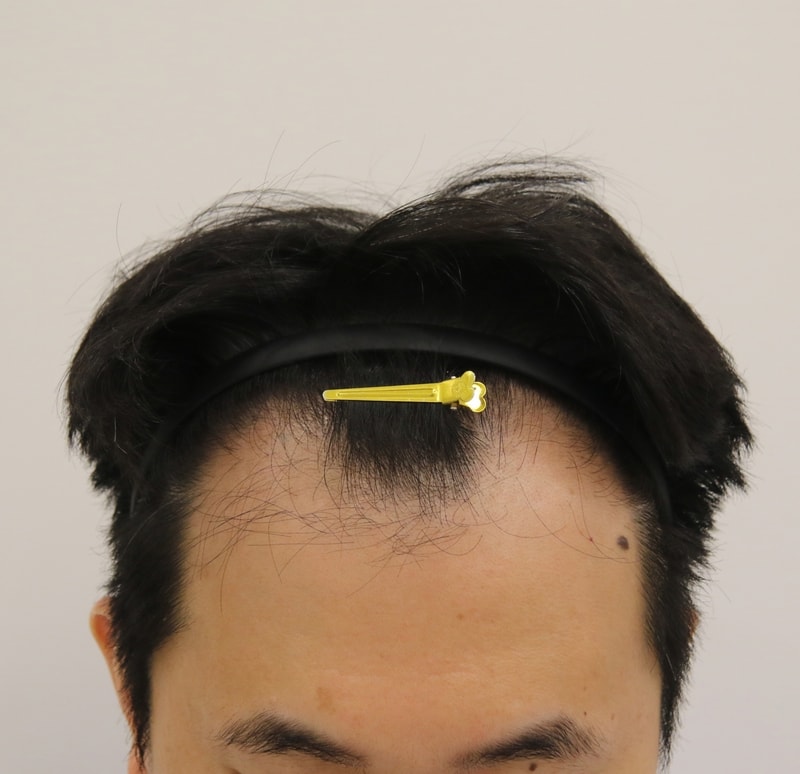 초진정면.jpg