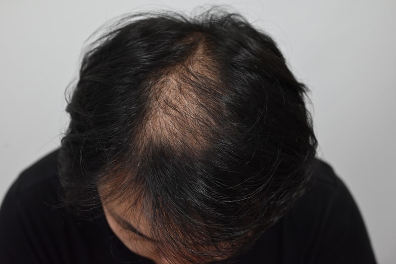before.jpg