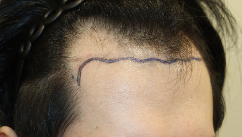 before.bmp