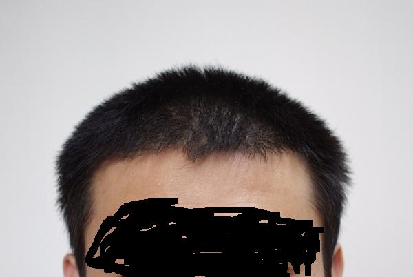 4개월1.JPG