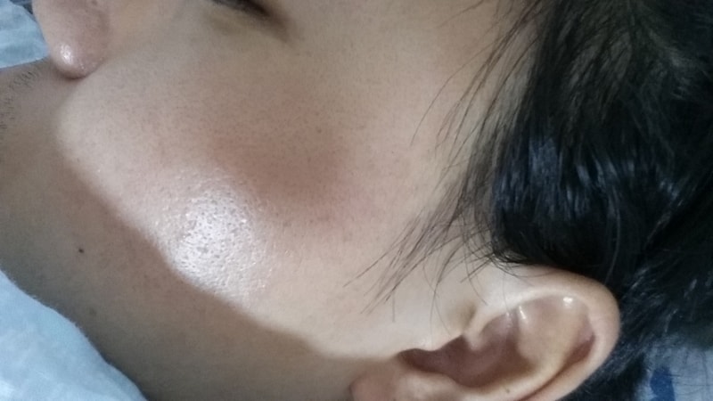 20170725_183317.jpg