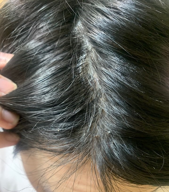 20201224 수술 10일차 3.jpg