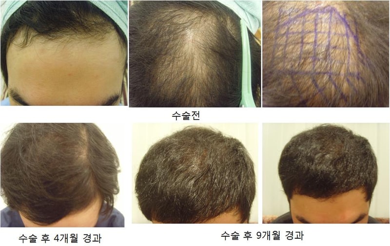 제목 없음.jpg