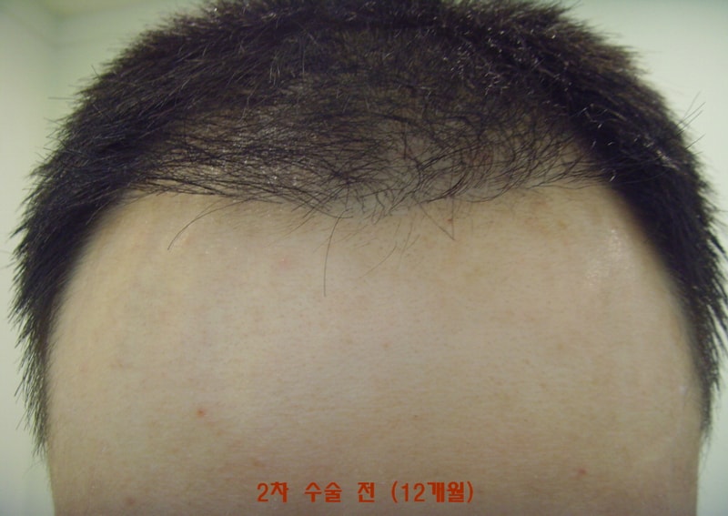 크기변환_꾸미기_SNV32418.JPG