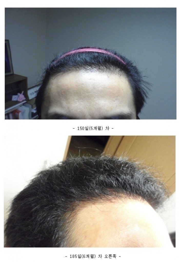6개월 오른쪽.jpg