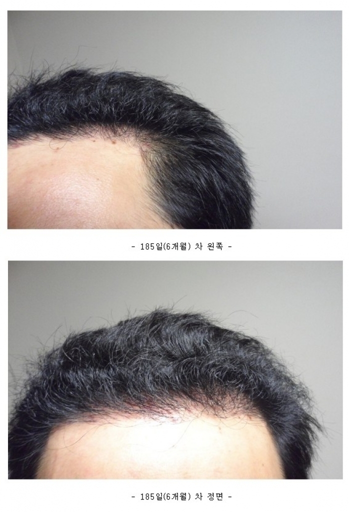 6개월 정면.jpg