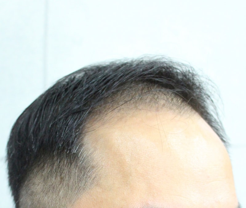 IMG_3109_4개월.JPG