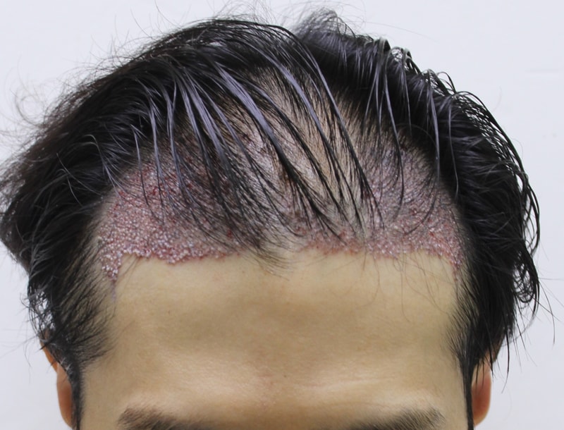 후1.JPG