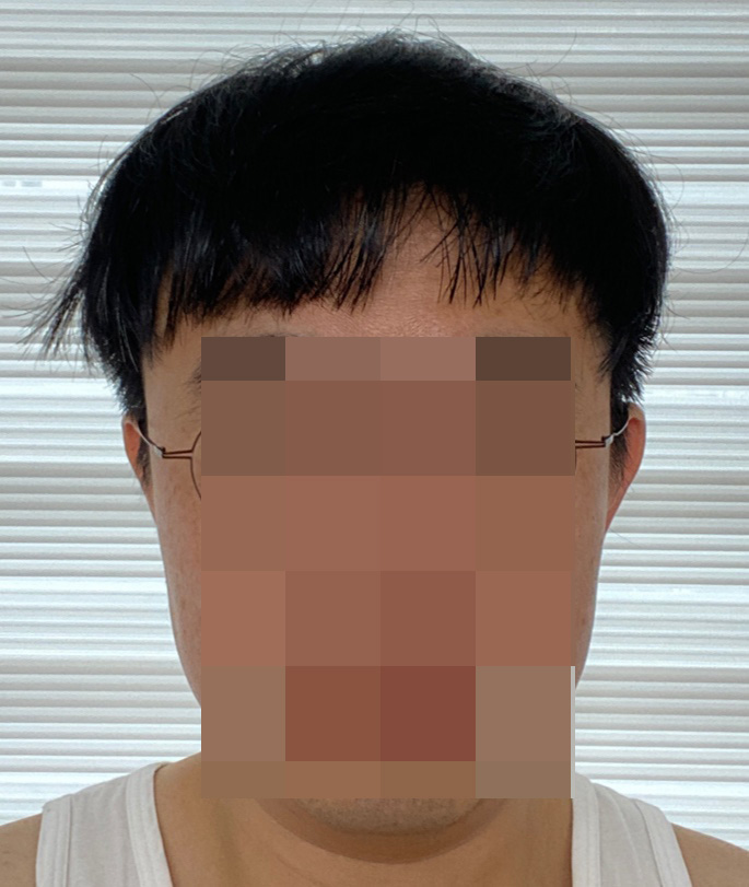2. 수술 다음날 1.jpg
