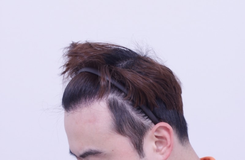 크기변환_1년후.jpg