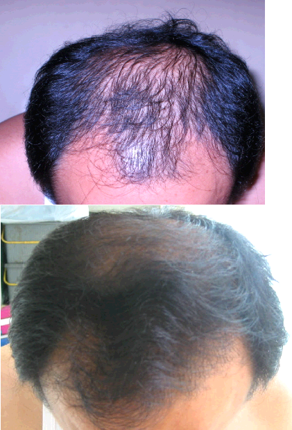 1-yr-diff.jpg