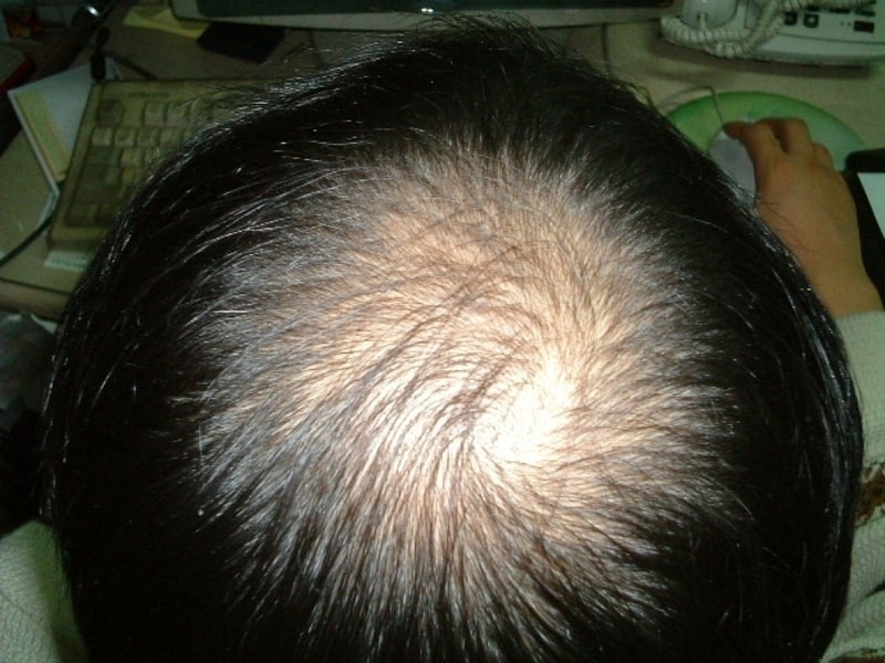 수술전.jpg