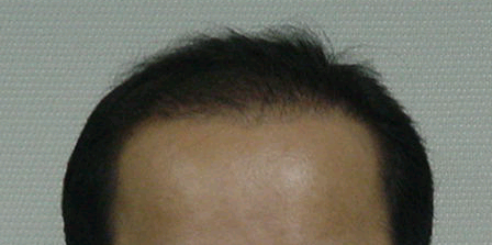4달후.bmp