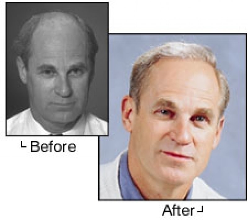 6b_before_after.jpg