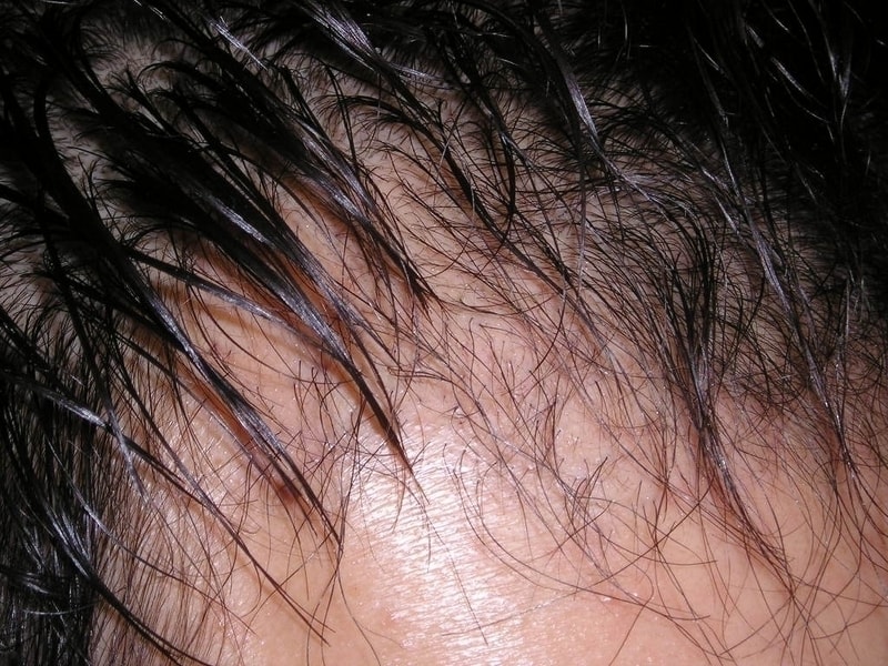 P1010003.JPG