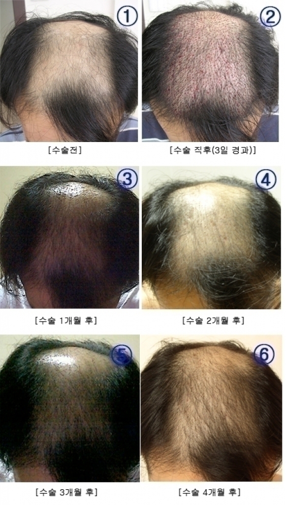 hair.jpg