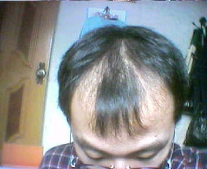 hair1.jpg