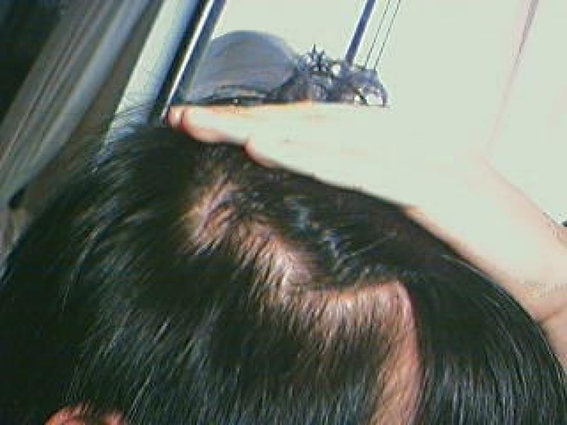 옆..jpg