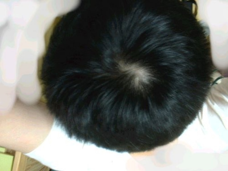 정수리.JPG