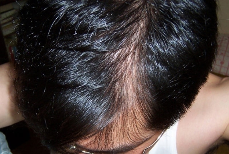 side1.jpg