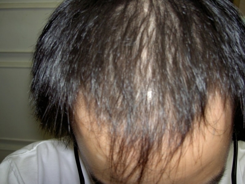 PICT0038.JPG