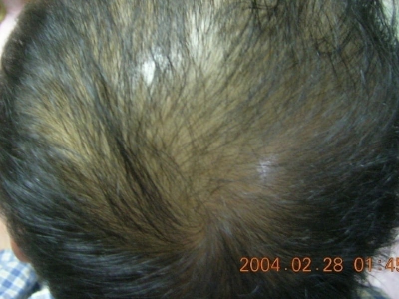 ALSeeEdit_RSCN0092.JPG