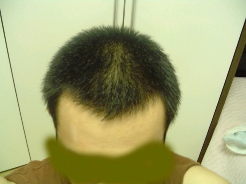 93.jpg