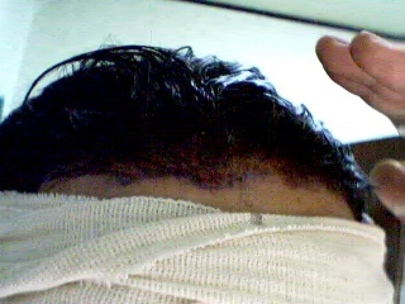 after1.jpg