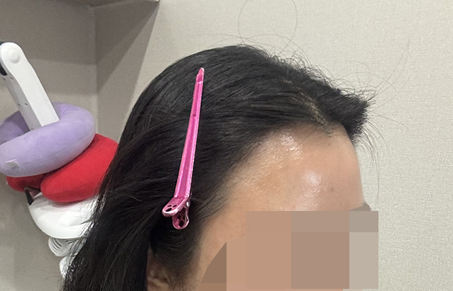 7. 경과보러 제때 못가서 주사 맞고 왔어요.jpg
