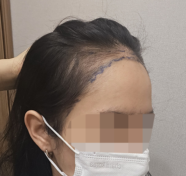 6. 우측 셀카.jpg