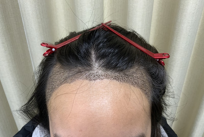 김진주 1주경과1.jpg