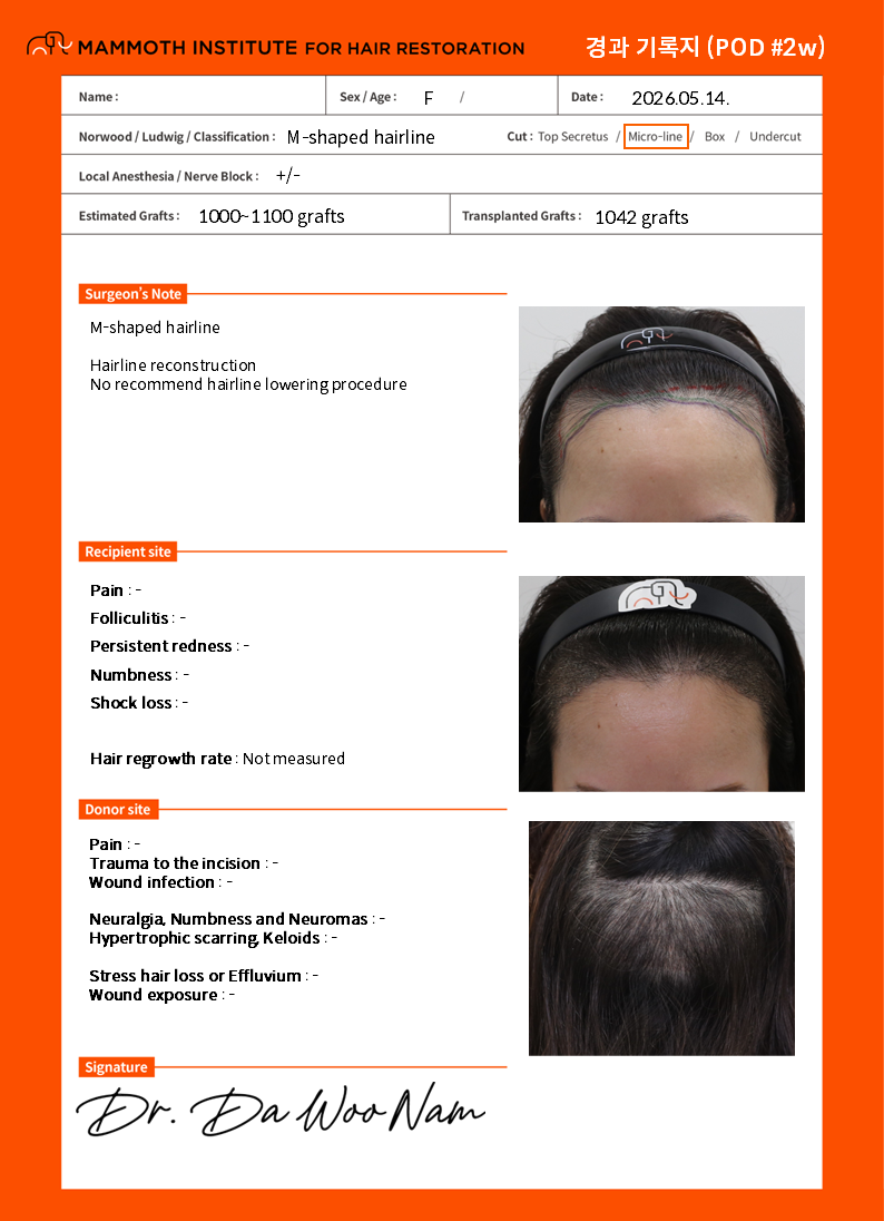仁川Mammos发际线非切开毛发移植2周后来看的