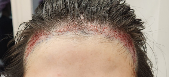 IMG11126.png