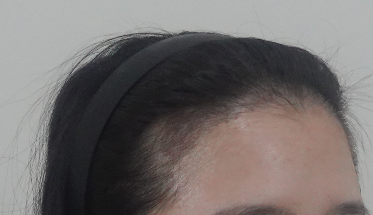 IMG11127.png