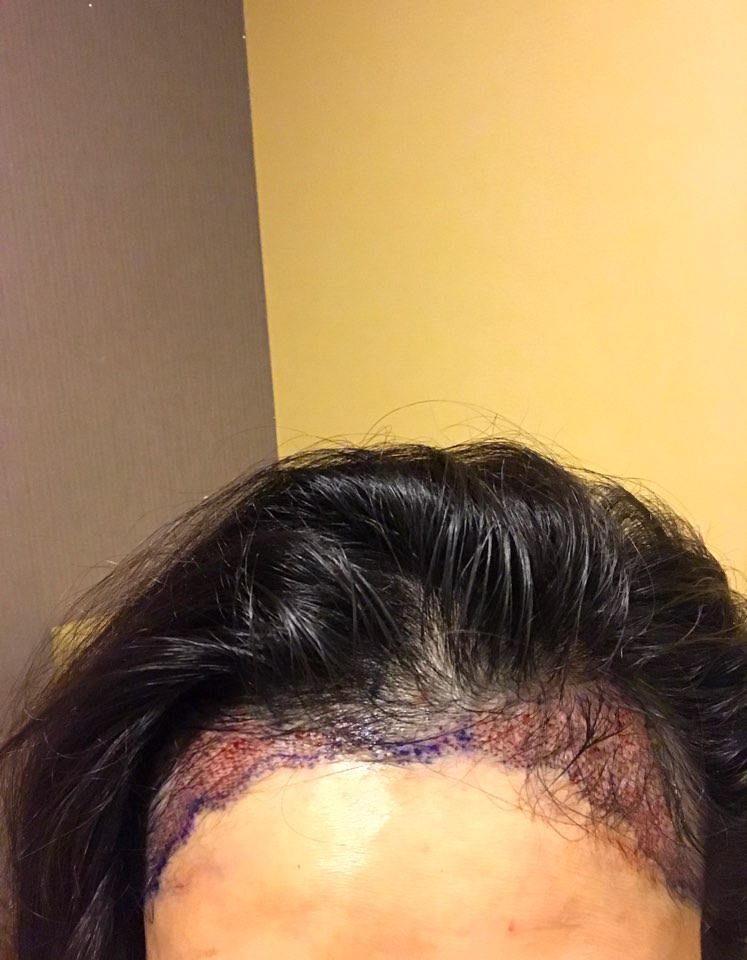 KakaoTalk_20170105_174610592.jpg