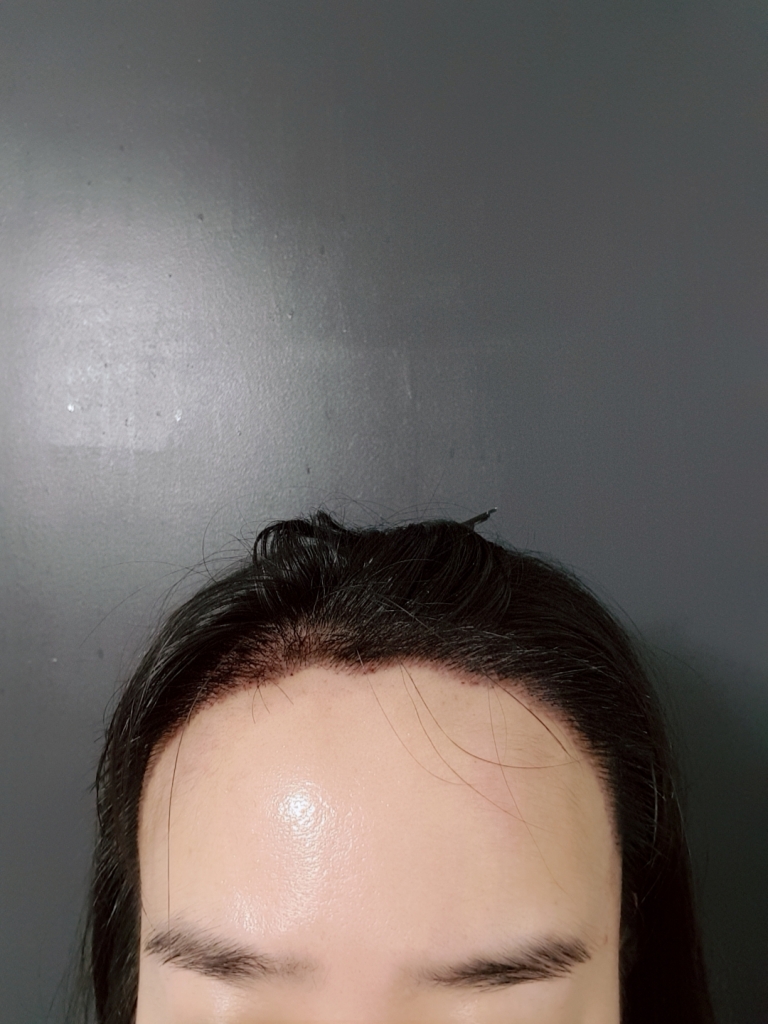 20180702_092500_969.jpg