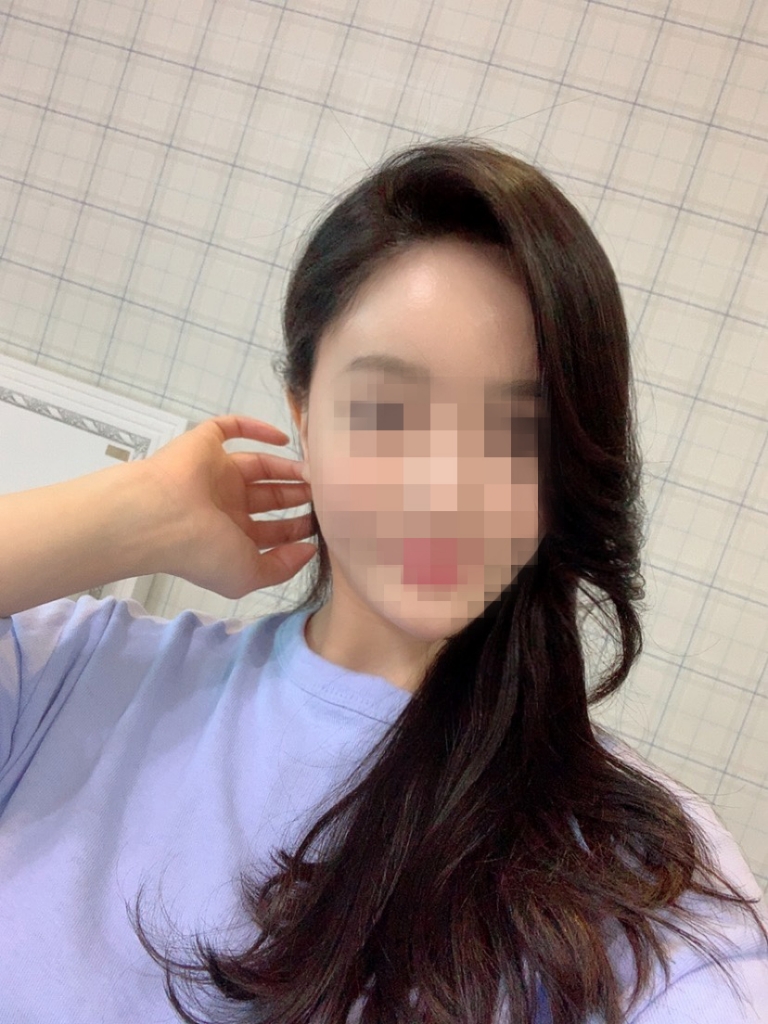07.이윤주_수술7달.jpg