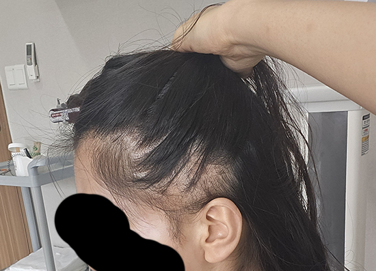 5 오늘주사 맞기전.jpg