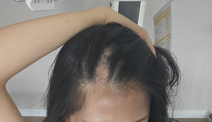 4 오늘 주사맞기 전.jpg